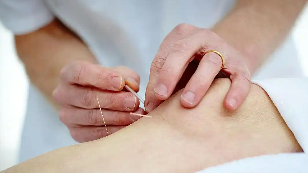 为了更熟练 医学生在自己身上练针灸