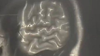 女子熬夜3个月突然开始对墙讲课